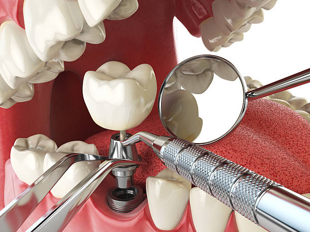 Best Broken Tooth Emergency  in Keene, TX